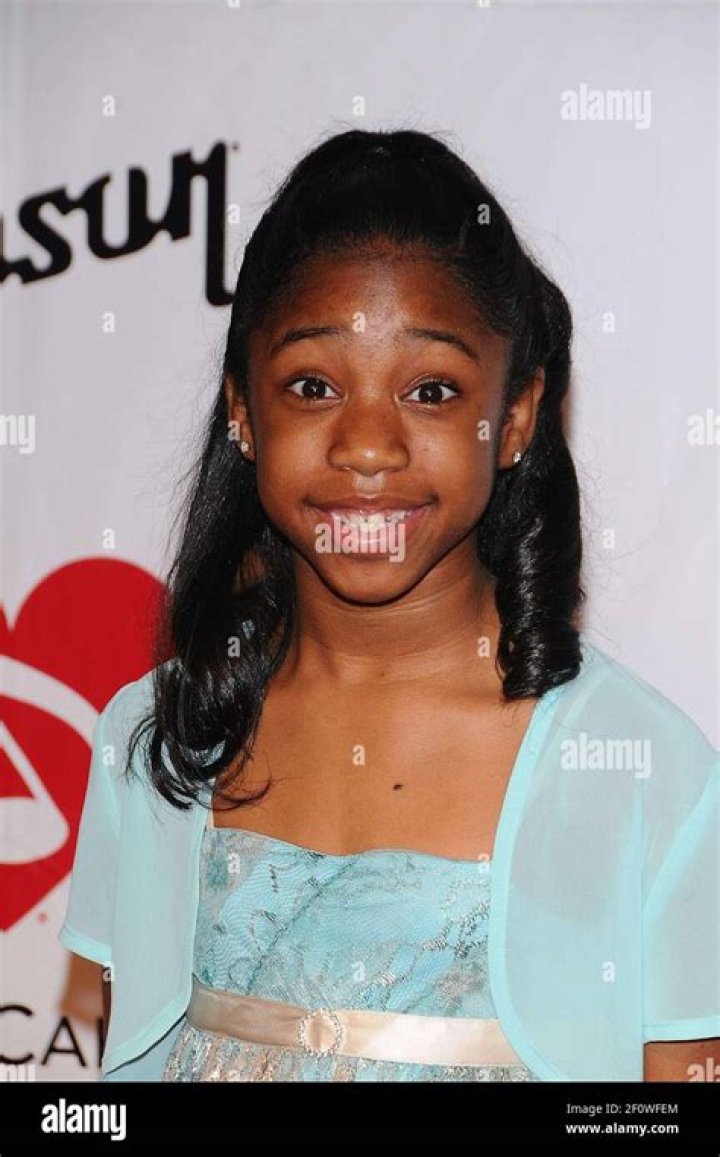 Aches Height, Weight, Net Worth, Age, Birthday, Wikipedia, Who, Instagram, Biography