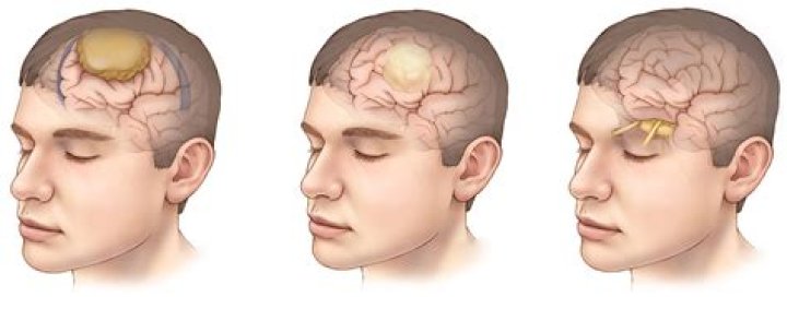 Anthony Miranda Shot In Head, Eye Injury: What Happened To Him?