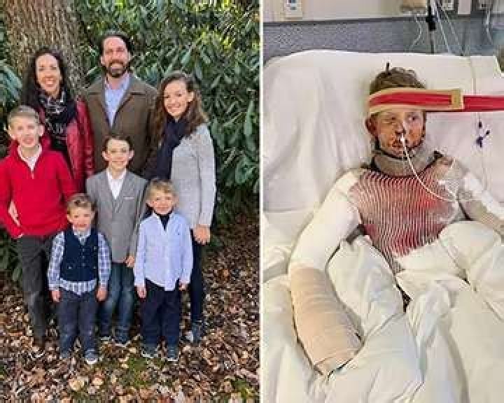 
Barrett McKim,12, After his science experiment went off, suffered third-degree burns 