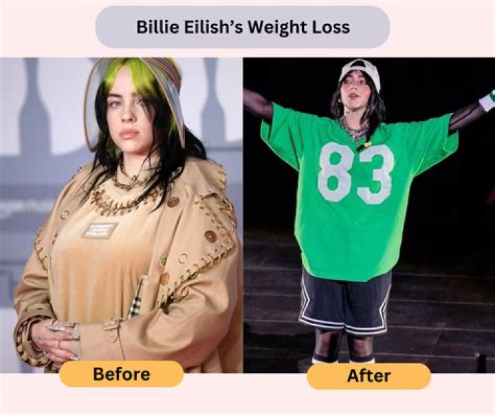 Billie Eilish Weight Loss Transformation: Here Are Before And After Pictures
