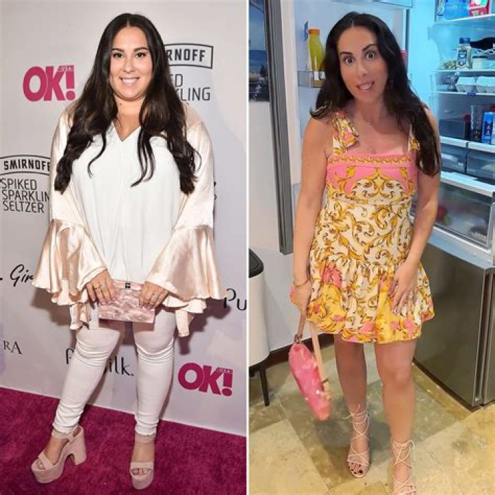 Claudia Oshry Weight Loss Viral On Reddit: Before And After
