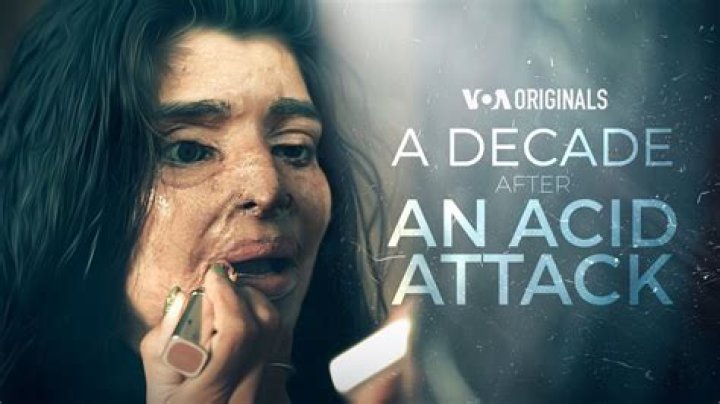 
Dana Vulin An Acid Attack Victim On A Quest To Make Scars Sexy In Lingerie Transformation 