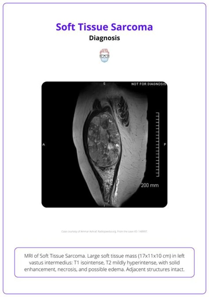 Did Cindy Joseph Die From Soft Tissue Sarcoma? Model Career and Wikipedia