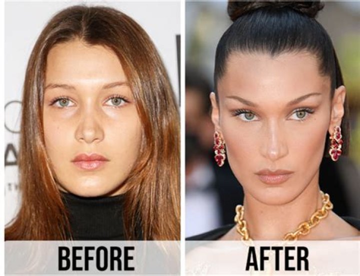 Does Bella Hadid Have Any Kind Of Eating Disorder? Model Anorexia Condition And Transformation Photos