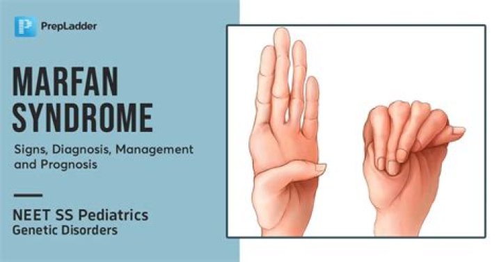 Does Chet Holmgren Have Marfan Syndrome? Details On Gonzaga Bulldogs Illness And His Parents Nationality