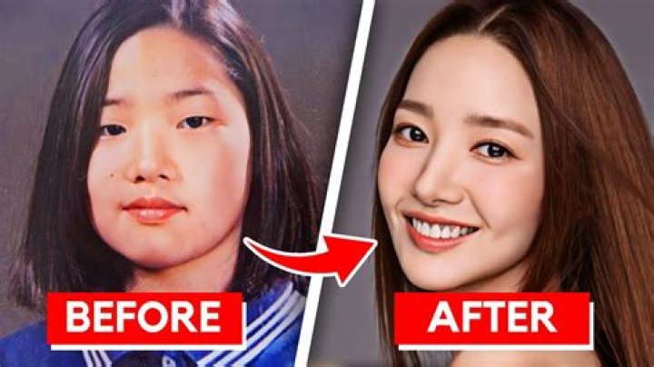 Has Kim Kun Hee Done Plastic Surgery?