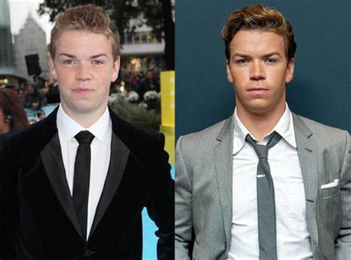 
Has Will Poulter Had Plastic Surgery? Will Poulter On Body Transformation 