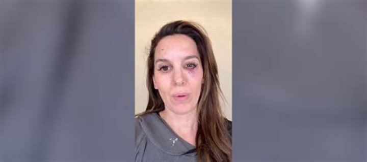 
Is Christy Dignam Still Alive? What Happened To Christy Dignam? 