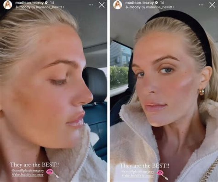 Is Madison Lecroy Mouth Crooked Because Of Plastic Surgery?