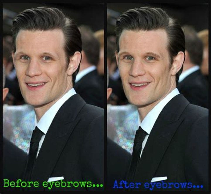 Is Matt Smith No Eyebrows linked To Cancer? Illness And Disease Update