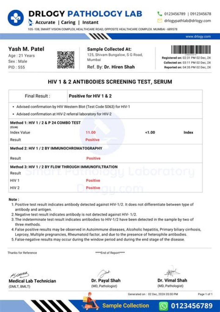 
IVD’s HIV 1 And 2 Test Screening Result Has Been Shared Online 