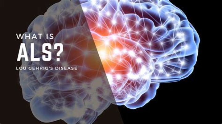 
James Yeager Illness: What Is ALS Disease? Symptoms And Health Update 