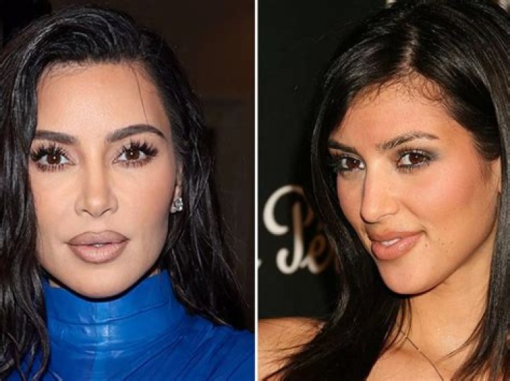 
Kim Kardashian Before And After Looks: The Socialite’s Plastic Surgery Journey Explained 