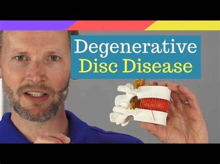 
Pen Medina Is Diagnosed With Degenerative Disc Disease 