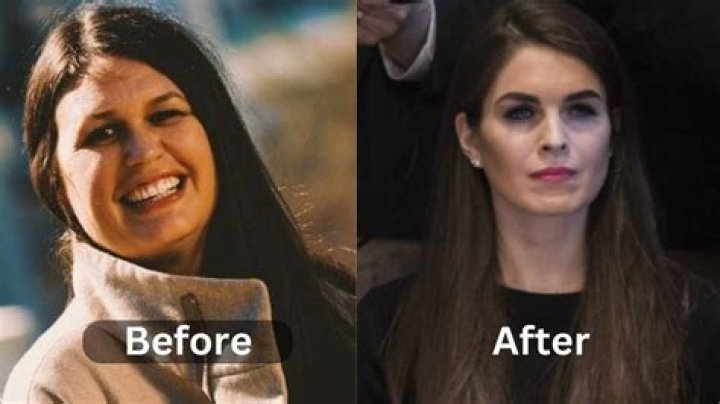 Sarah Huckabee Sanders Plastic Surgery | Before And After Photos