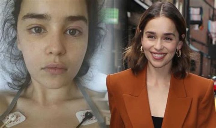 What Illness Does Emilia Clarke Have? Health Condition Explored