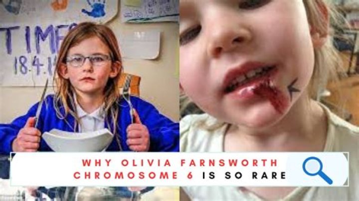 Where Is Olivia Farnsworth Who Does Not Feel Pain? Meet The Girl With Rare Chromosome Case