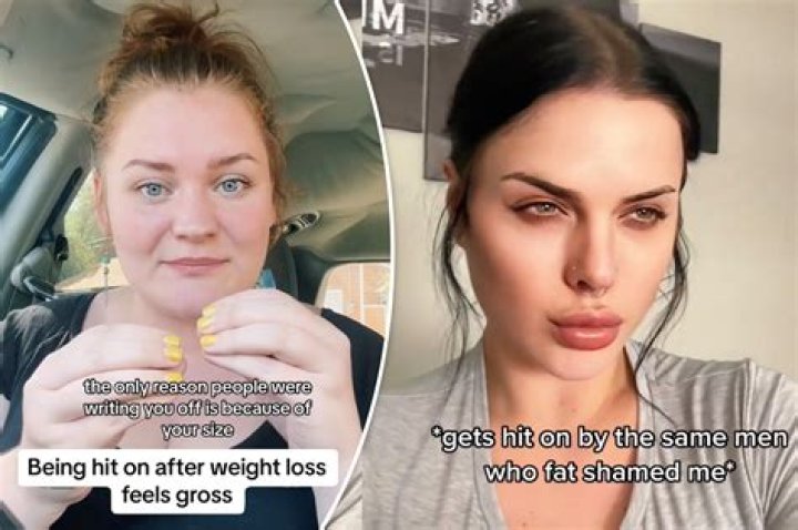 
Who Is Caito Potato & What Happened To Her? Weight Gain & Disease 