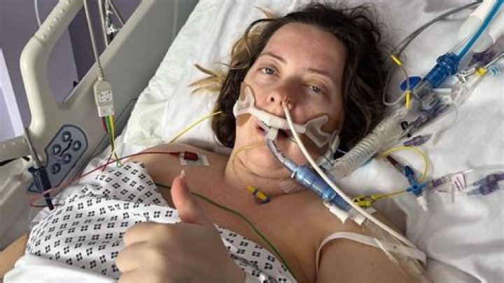 
Who is Charleigh Chatterton, English woman who nearly died from rare flesh-eating bacteria? 