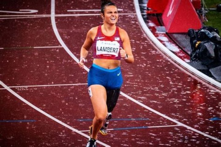 
Who is Noelle Lambert? What happened to her leg? Makes Survivor history 